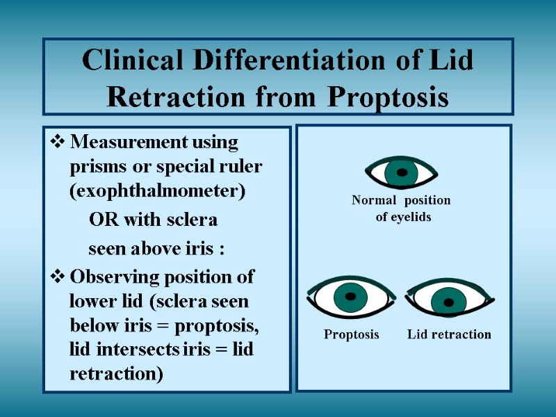 Clinical Differentiation of Lid Retraction from Proptosis Measurement using prisms or special ruler (exophthalmometer)